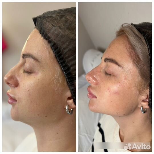 Косметолог лицо под ключ