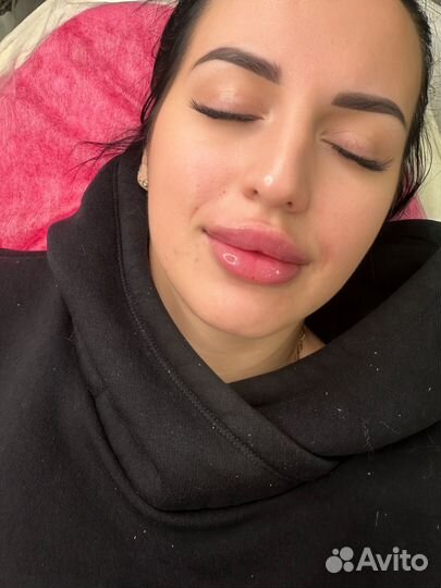 Увеличение губ