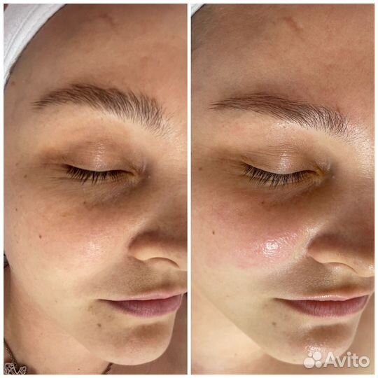 Услуги косметолога