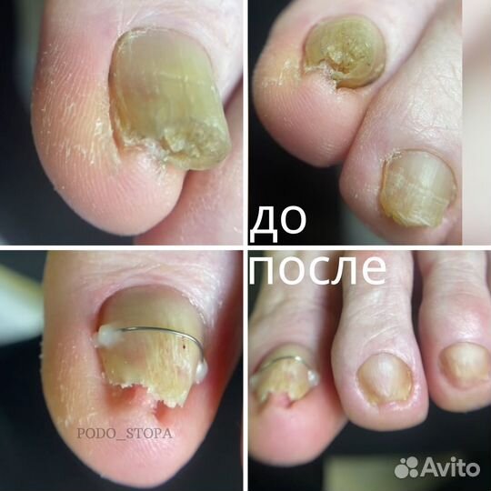Подолог. Педикюр