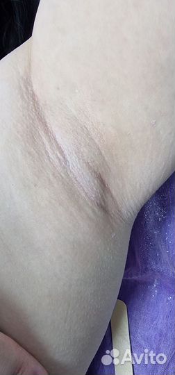 Депиляция/ Ваксинг