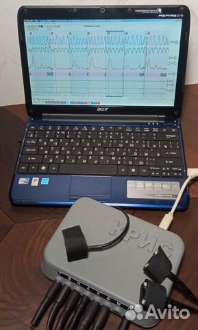 Проверки на полиграфе (детекторе лжи). Опыт 20 лет