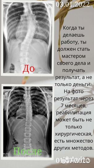 Костоправ, Мануальный массаж, Массажист