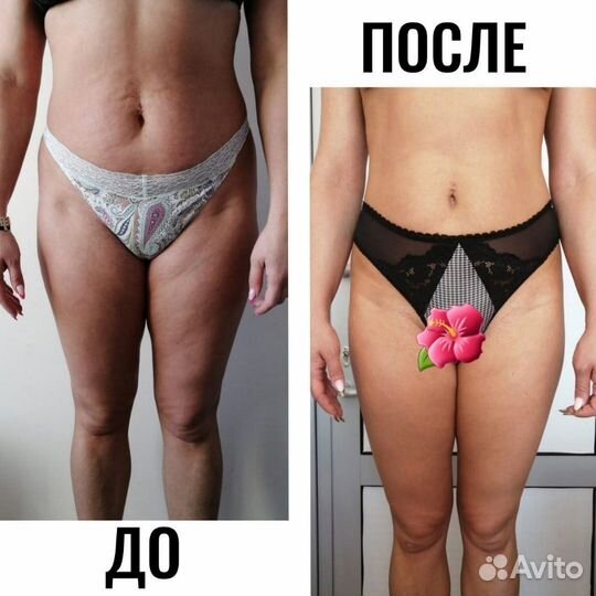 Биоэнергетический массаж