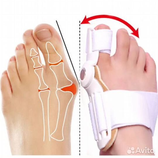 Корректор выпрямитель большого пальца ноги