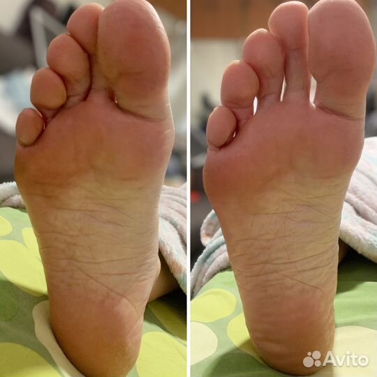 Массажист / Массаж