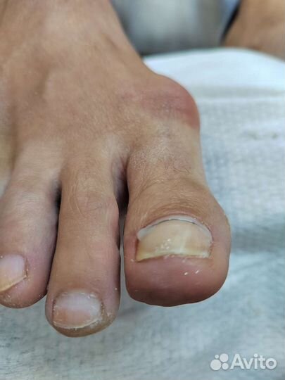 Подолог. Медицинский педикюр