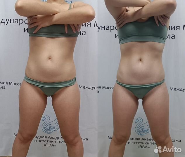 Липомоделирующего SPA - релакс массажа; кинезиотей