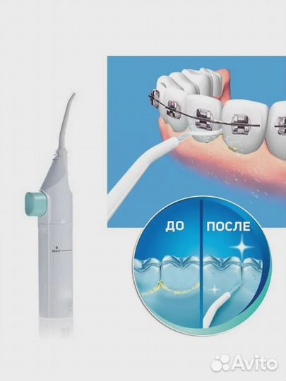 Ирригатор для полости рта