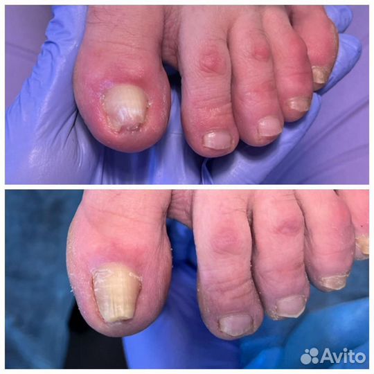 Маникюр Педикюр Подология