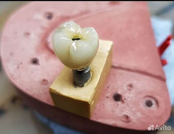 Зубной техник керамист