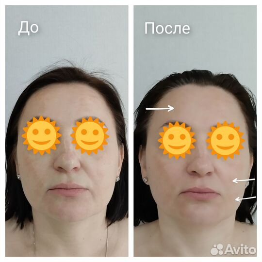 Массаж лица