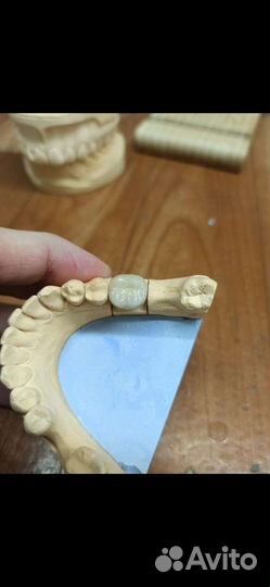 Зубной техник керамист