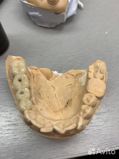 Приглашаю стоматологов ортопедов к сотрудничеству