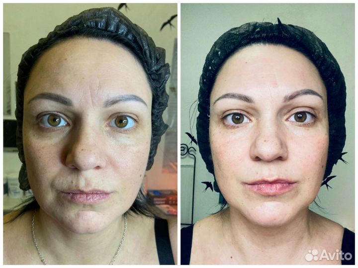 Скульптурный массаж лица