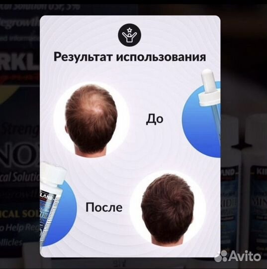 Миноксидил 5