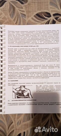 Миофасциальные боли и дисфункции, Дж Трэвелл