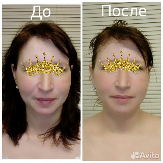 Профессиональный массаж