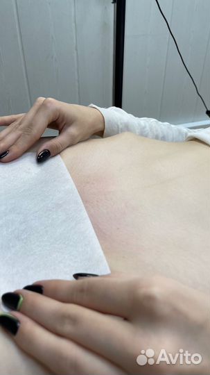 Шугаринг депиляция