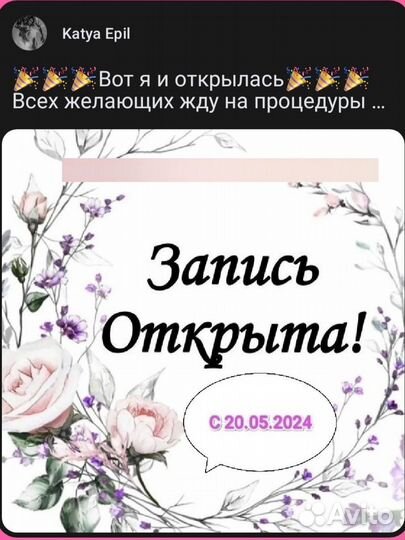 Электроэпиляция