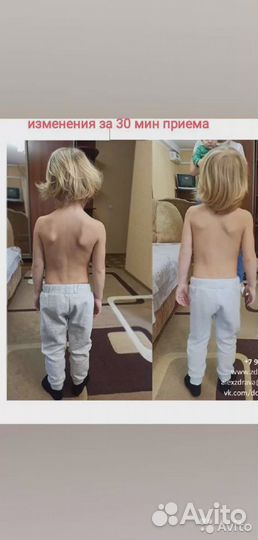 Кинезиолог Костоправ Краниальный Висцеральный