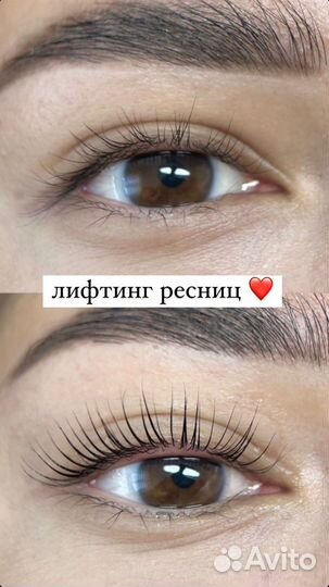 Лифтинг ресниц