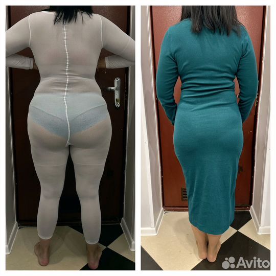 LPG-массаж тела и лица