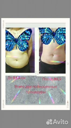 Аппаратный Массаж