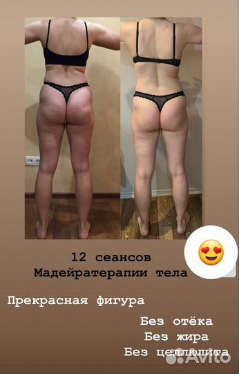 Массаж