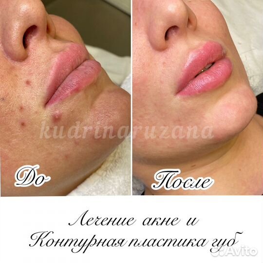 Услуги косметолога