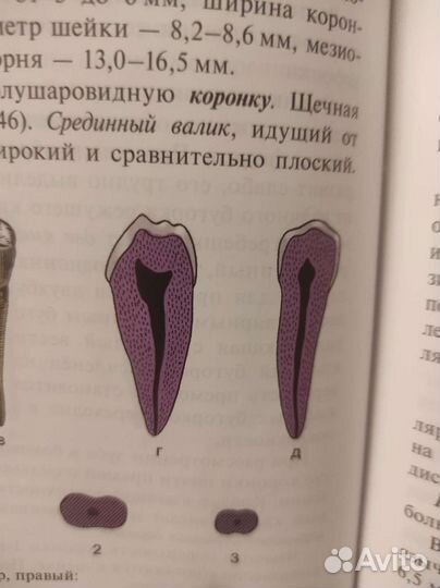 Помощь с экзаменами. Микронаушник. Помощь с учебой