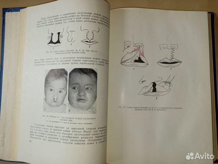 Оперативная челюстно-лицевая хирургия. 1963