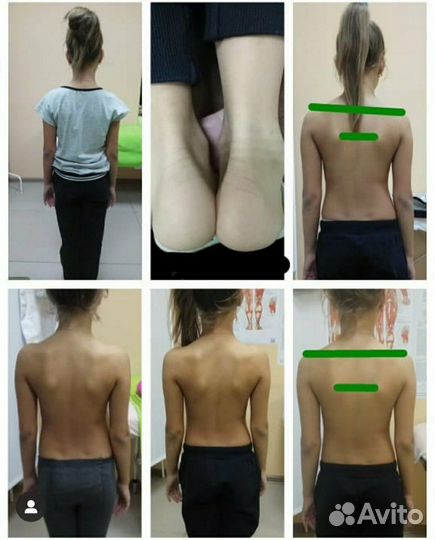 Юмейхо, Висцеральная терапия