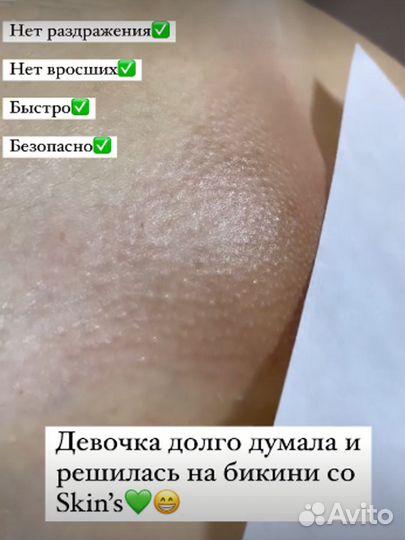 Депиляция волос Инновационным методом