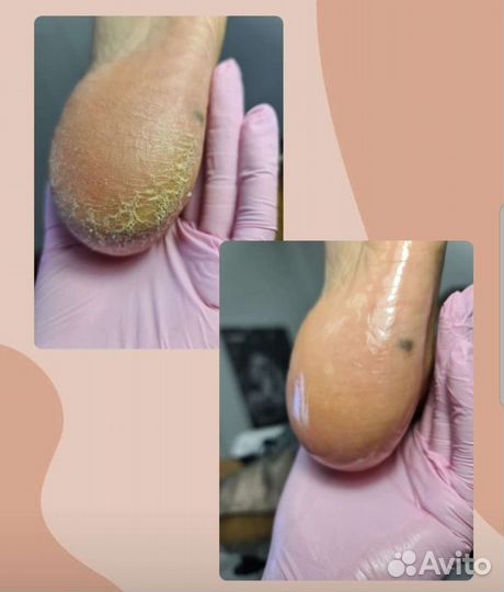 SMART - педикюр