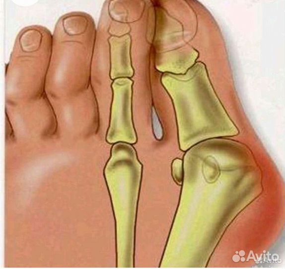 Силиконовый разделитель пальцев пара 2шт