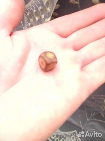 Камень из желчного пузыря