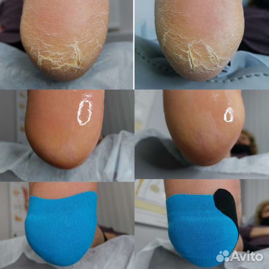 Подолог Бутово. Услуги подолога