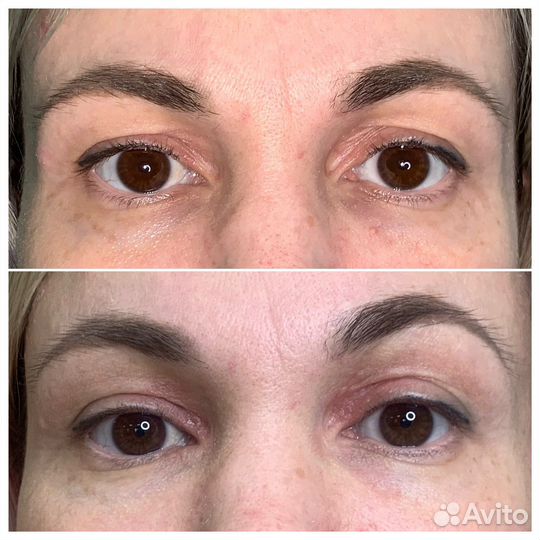 Холодная плазма + обучение