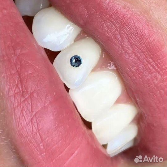 Модели на скайсы и осветление эмали