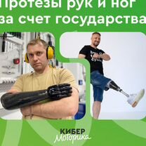 Протезы рук и ног