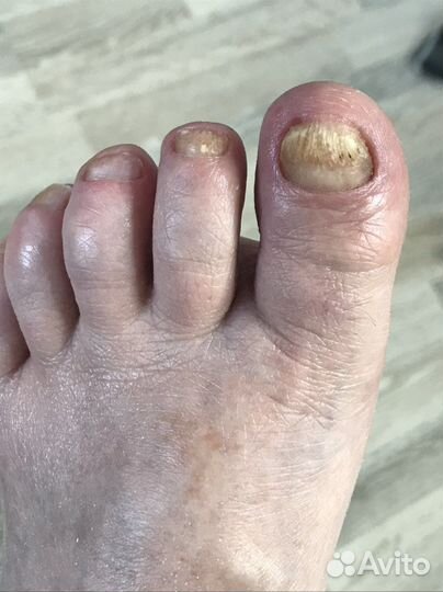 Услуги подолога