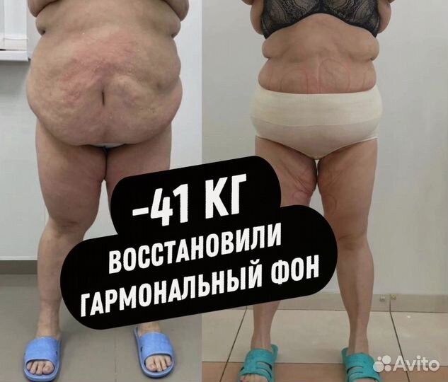 Массаж Лица Антицеллюлитный Коррекция Аппаратный