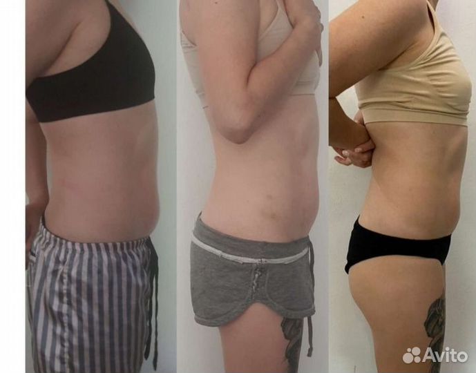 Массаж ручной/аппаратный (женщины и мужчины)