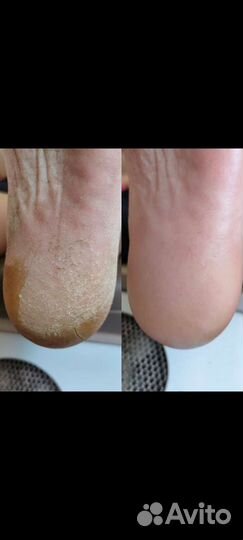 Маникюр и педикюр