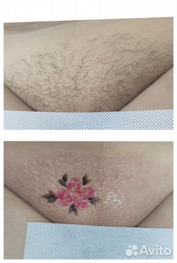 Депиляция воском