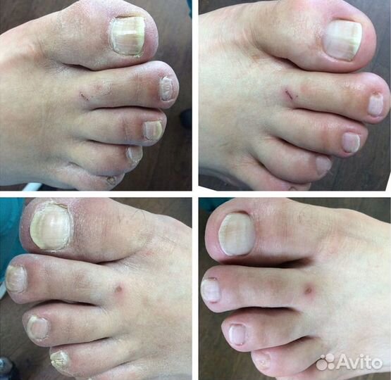 Маникюр, аппаратный педикюр