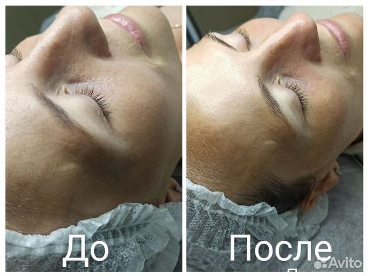 Услуги косметолога