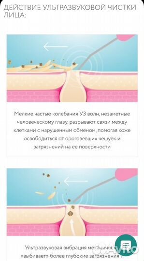 Аппарат косметический уз чистка