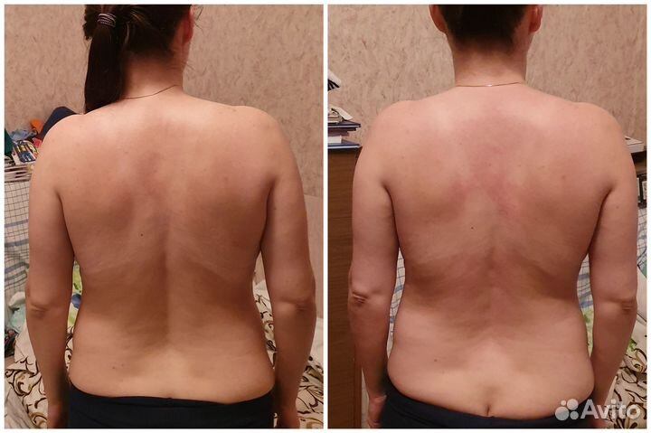 Массаж остеопатический мануальный (костоправ)